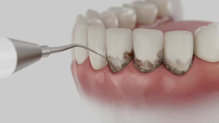 Reliable Dental Implants contractor in Babbitt, MN by Smile Center Dentistry